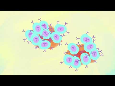 Dr. Susan Love Research Foundation - CAR-T Explained - Whiteboard Animation