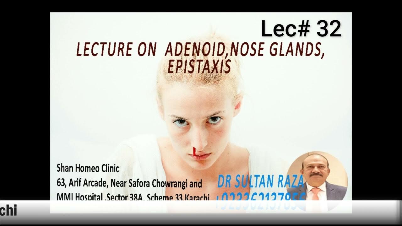 best-lecture-on-nose-bleeding-by-dr-sultan-raza-sultanraza-youtube