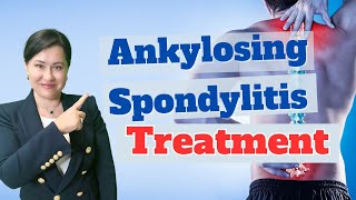 Unveiling The Treatment for Ankylosing Spondylitis