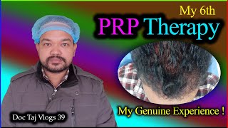 PRP Therapy/ My 6th PRP with derma roller/ Hair growth/Hair fall problem solution/Hair transplant