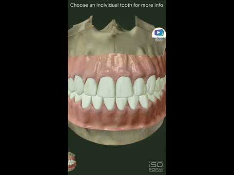 Video: Pişiklərdə Ləkələnmiş, Rəngsizləşmiş Dişlər