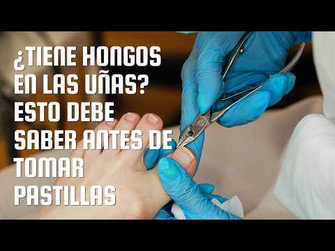 ¿Tiene hongos en las uñas? Esto debe saber antes de tomar pastillas | Dr. Luis Felipe Felipe