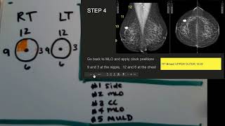 How to Read a Mammogram