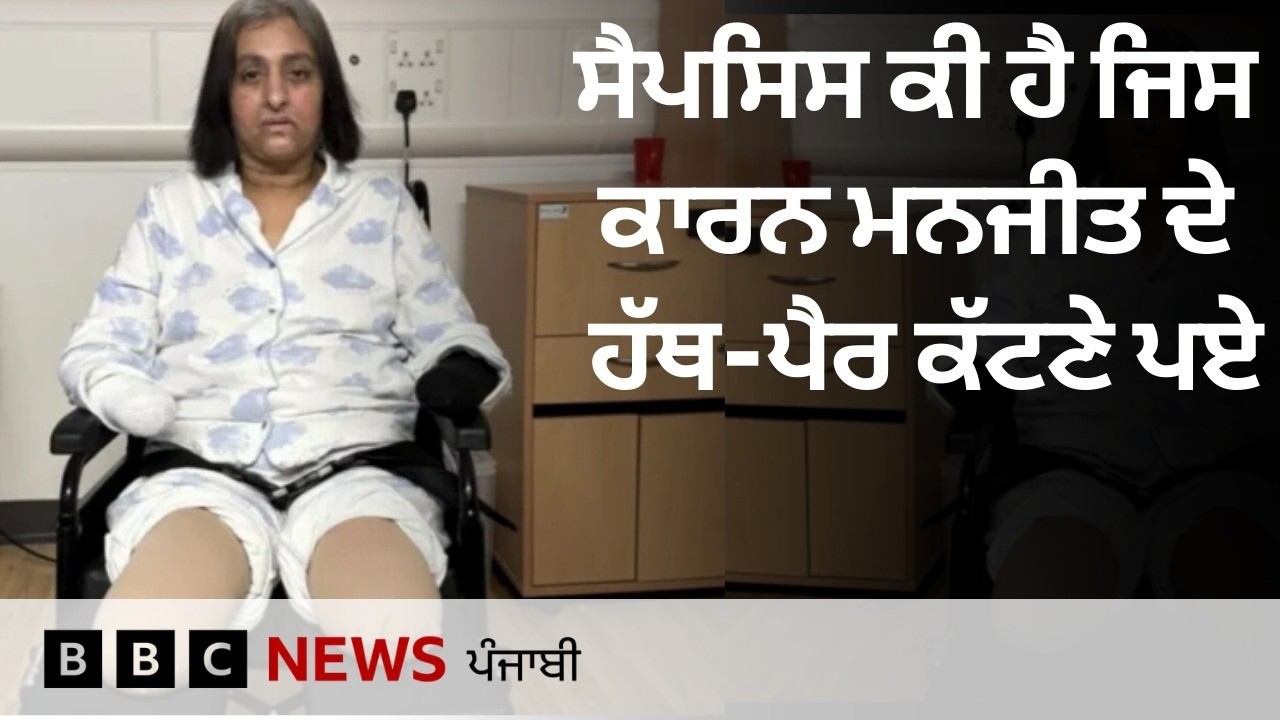 sepsis disease ਕਾਰਨ ਮਹਿਲਾ ਦੇ ਹੱਥ-ਪੈਰ ਕੱਟਣੇ ਪਏ, ਕੀ ਕੁੱਤੇ ਵੱਲੋਂ ਜਖ਼ਮ ਨੂੰ ਚੱਟਣਾ ਇੰਨਾ ਖ਼ਤਰਨਾਕ | 𝐁𝐁𝐂