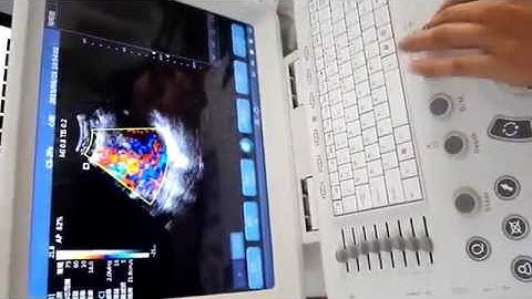 Cardiac Probe color doppler MSLCU26 video/MSL laptop Color Doppler USG for sale
