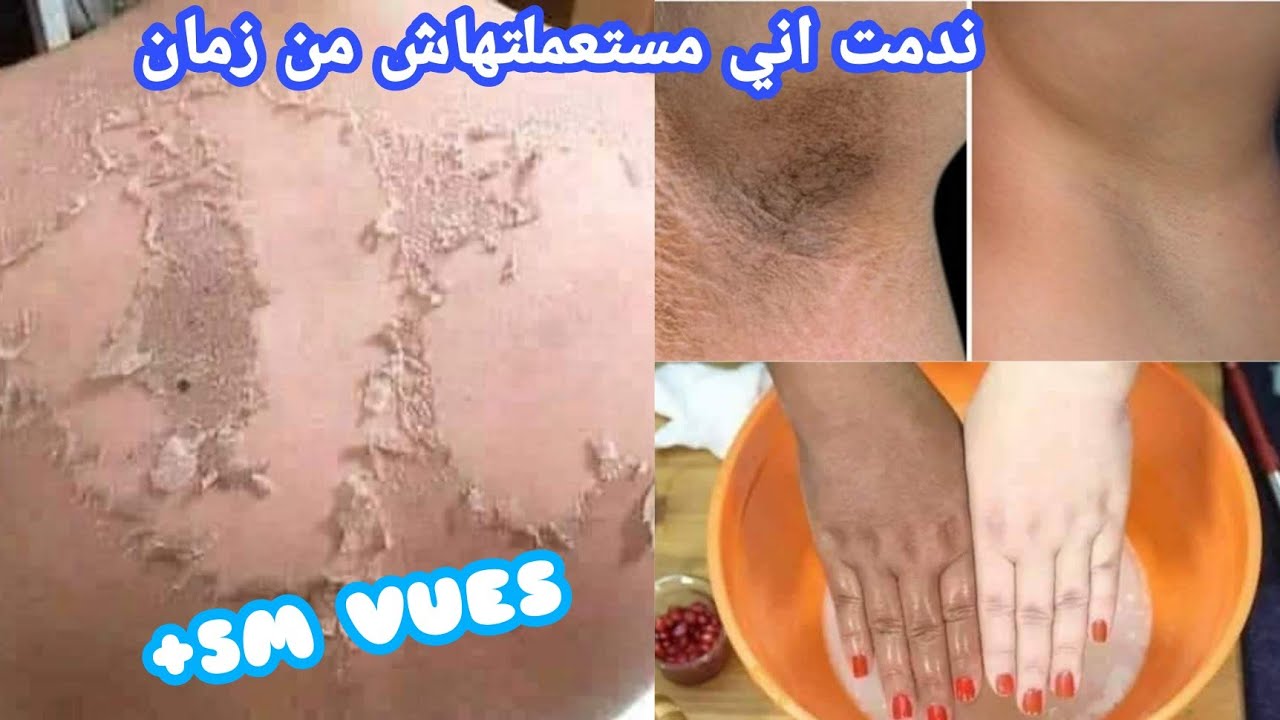 Клянусь Богом, сильнейший рецепт отбеливания, от которого ваше лицо и тело становятся белыми