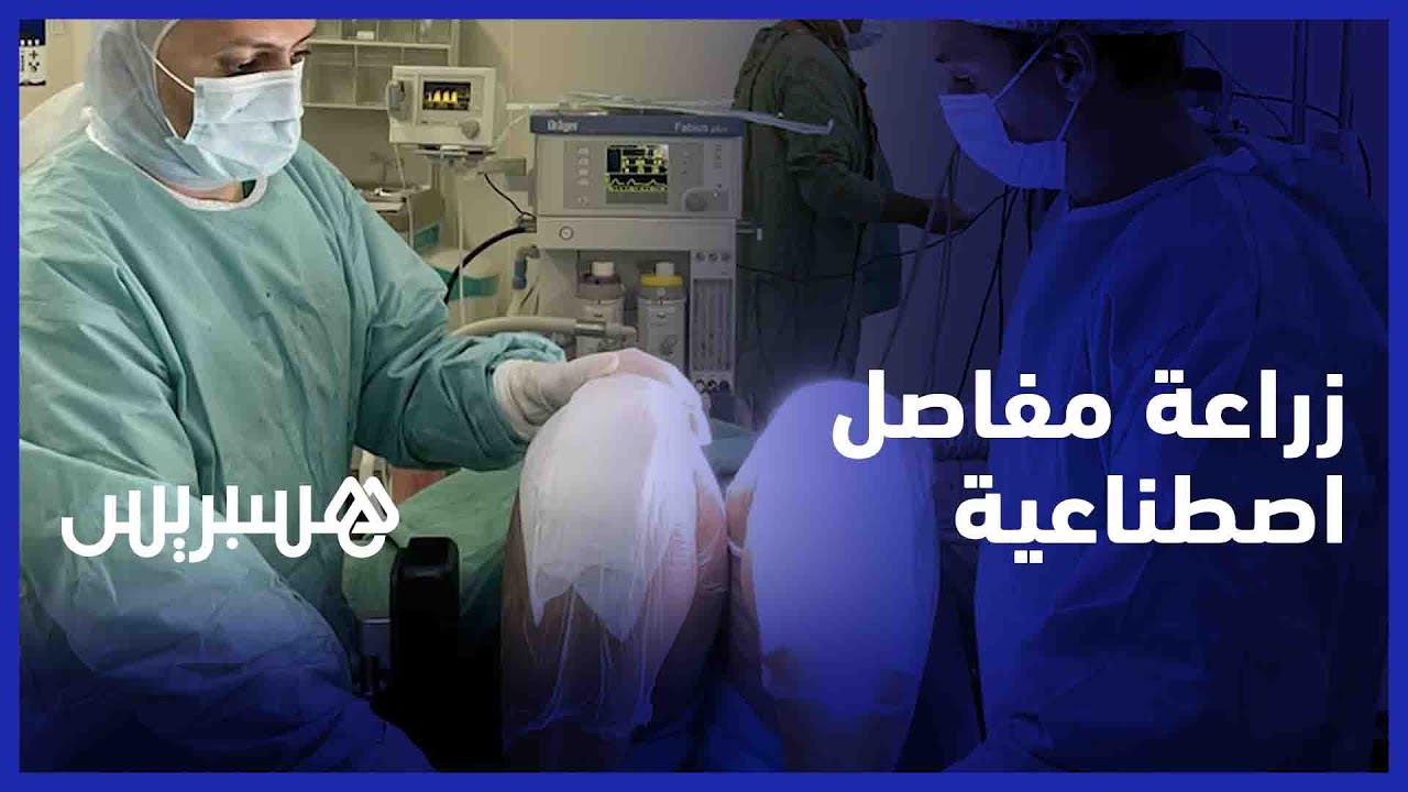 عملية جراحية هي الأولى من نوعها في المغرب..طاقم طبي يجري زراعة مفاصل اصطناعية بتقنيات حديثة في مراكش