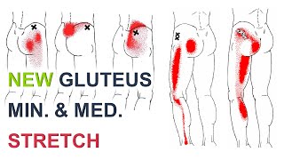 Stretches For Hip And Leg Pain | Gluteus Medius Pain