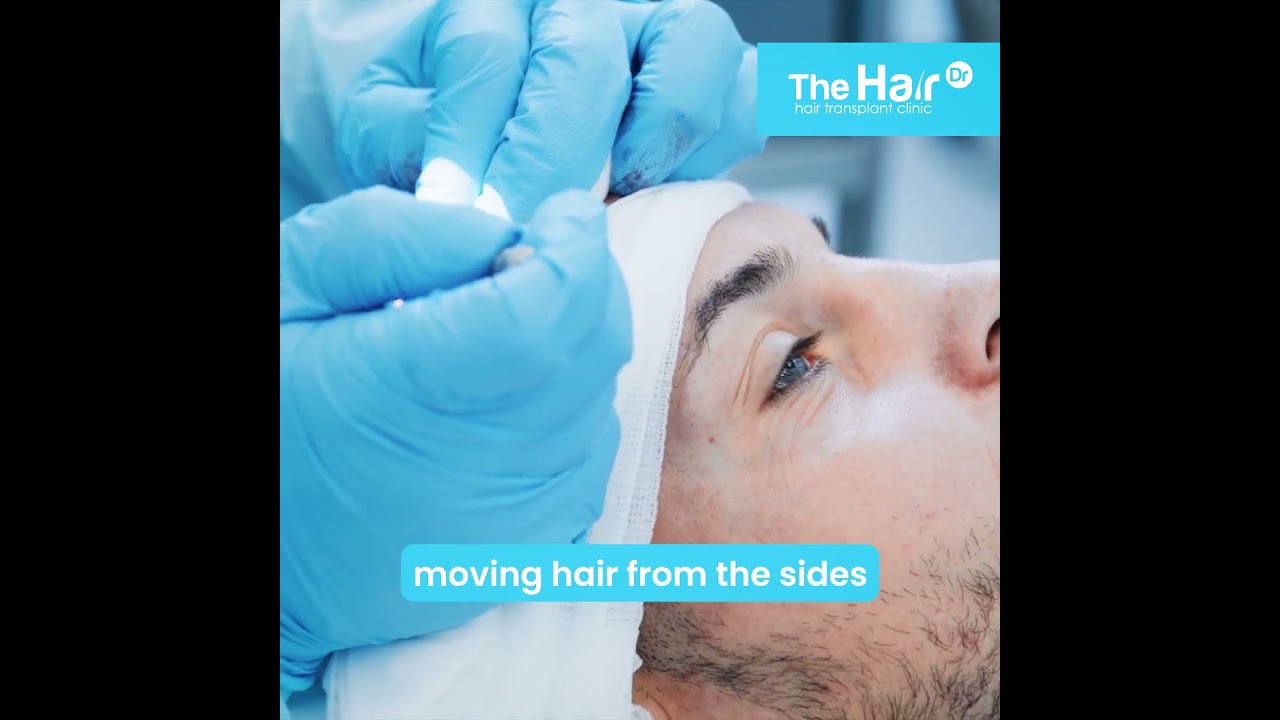 The Hair Dr Promo FUE