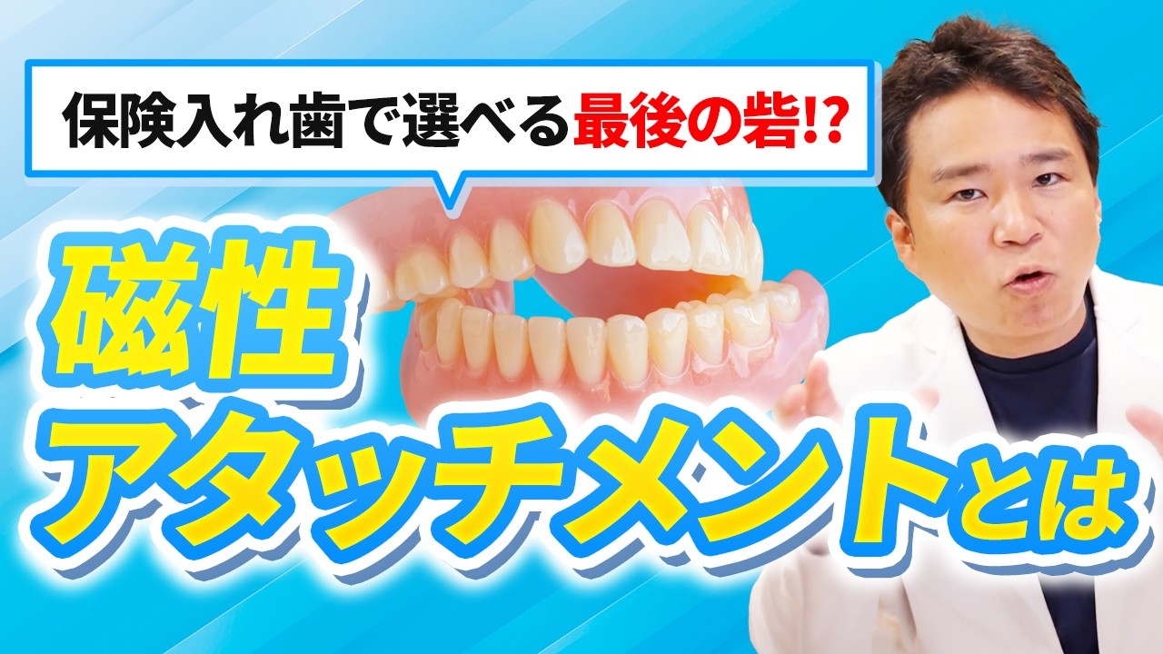 【これマジ？】保険で作れる磁石の入れ歯は本当に噛めるのか？