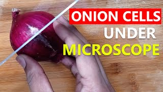 Onion Cell Under Microscope | Moving Cell Organelles of an Onion | Aimless Experiment 2022