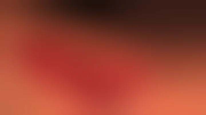 Tibial tubercle osteotomy and medial patellofemoral ligament reconstruction