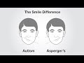 The smile difference autism vs asperger syndrome