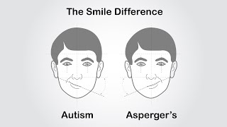 The Smile Difference: Autism vs. Asperger Syndrome