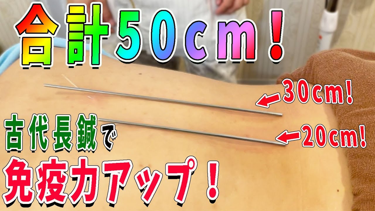 【免疫力アップ】古代鍼の一つ、長鍼で免疫力アップ!合計50cmの超ロング鍼! - YouTube