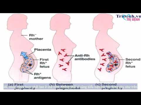 Video: Anti D hoạt động như thế nào trong thai kỳ?