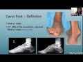 CavoVarus Feet Reconstruction