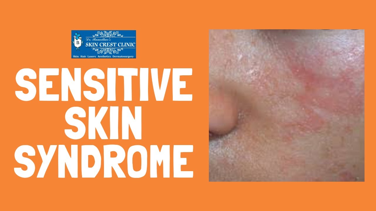 sensitive skin syndrome