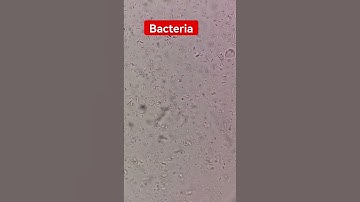 Bacteria under the microscope #laboratory #microscope #mls #cls #medtechstudent #bacteriology #micro