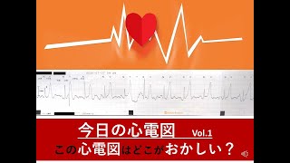 今日の心電図Vol 1　臨床のモニター心電図波形から心電図を勉強しよう！