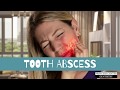 How a Dentist Treats an Abscess