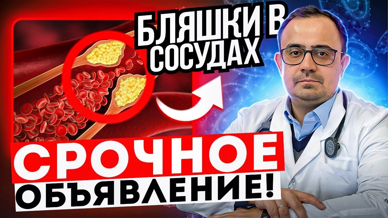 Холестерин / Атеросклероз. Цикл новых видео скоро на канале. - YouTube