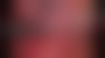 Laparoscopic Right Simple Nephrectomy for  Emphysematous Pyelonephritis (Without Editing)