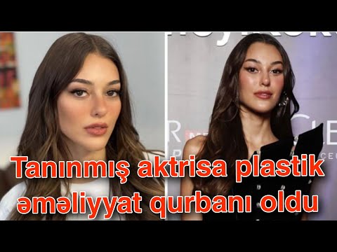 Tanınmış aktrisa plastik əməliyyat qurbanı oldu