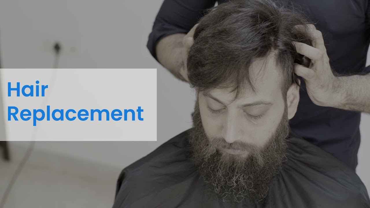 Hair Replacement Services | Hair Patch Fixing Services For Men