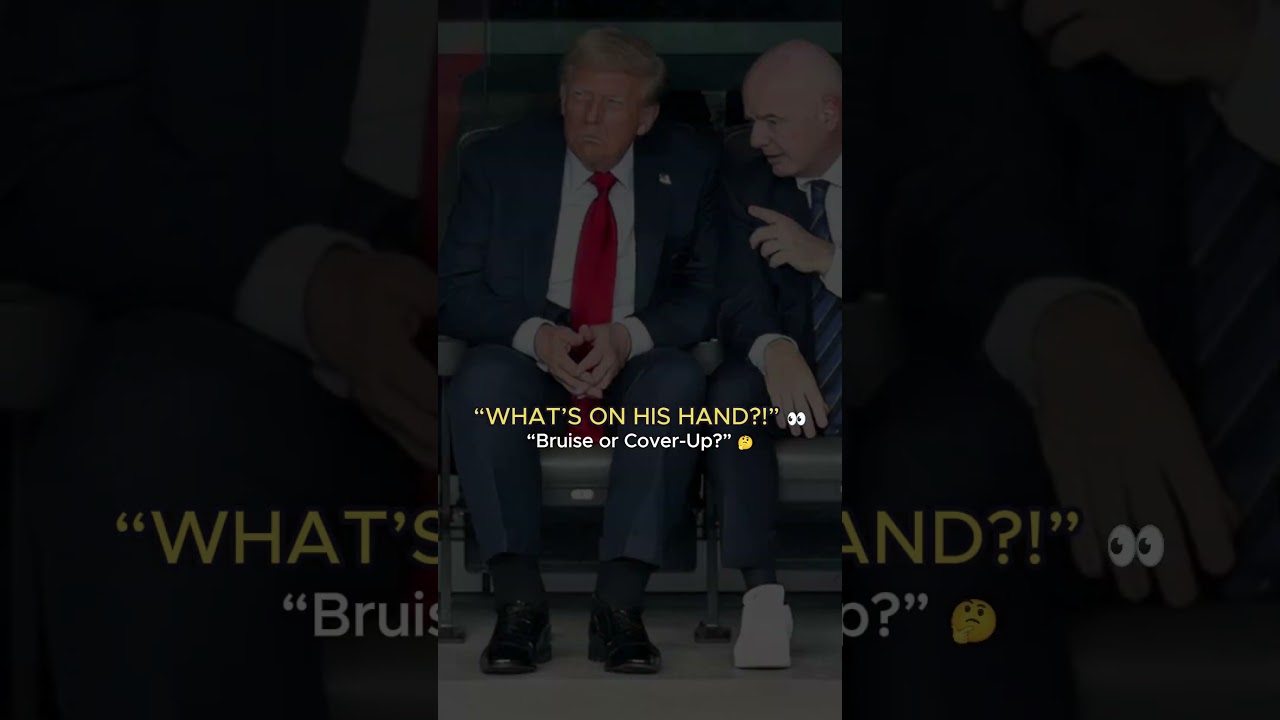 Trump’s Hand Mystery: Makeup Patch or Bruising? 👀 