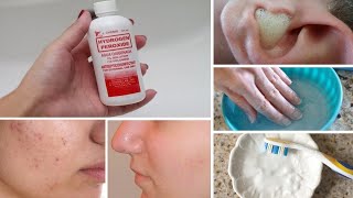7 Surprising Uses for Hydrogen Peroxide