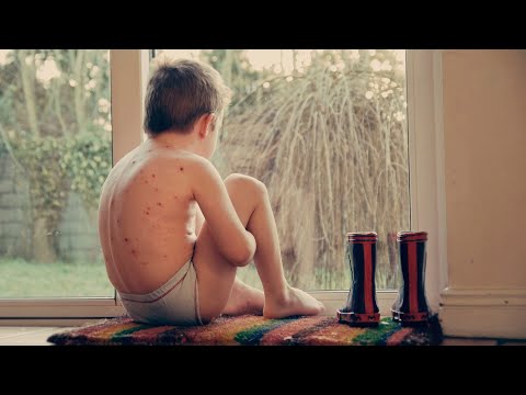 Videó: A Gyermekek Túladagolásának Tünetei