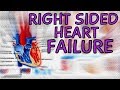 Right Sided Heart Failure - Explained in 2 Minutes  (Right Ventricle Failure)