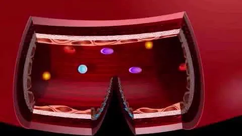 USMLE® Step 1 High Yield: Immunology, Hematology, and Oncology: Hemostais Animation