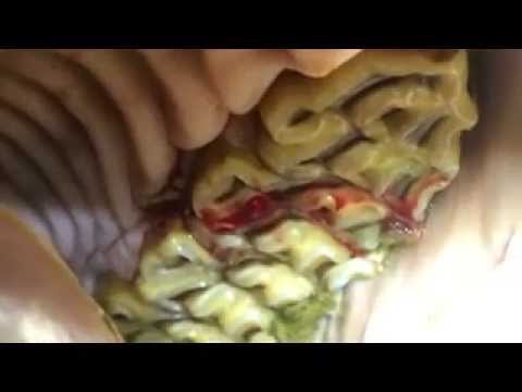 Horse Bot Larvae in Mouth - YouTube