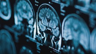 Impact of heat on your brain
