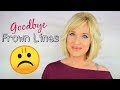 HOW TO GET RID OF Frown Lines, Eleven Lines, Glabella Lines! NO BOTOX OR FILLERS!