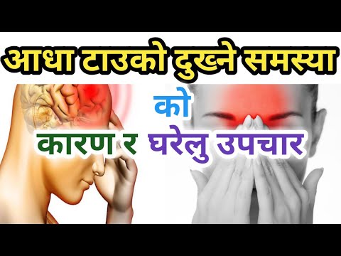 टाउको दुख्ने कारण र घरेलु उपचार विधी Symptoms Of Migraine || Nepali Health Tips