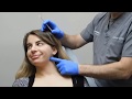 Defining the Jawline with Dysport / Botox with Dr. Janowski