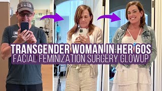 Dana's Life-Changing Transgender Facial Feminization Journey with Dr. Toby Mayer