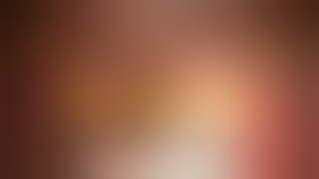 Technique of Intravitreal Injections | Is it Painful ? | Intravit Bevacizumab | Dr. Faisal Anwar