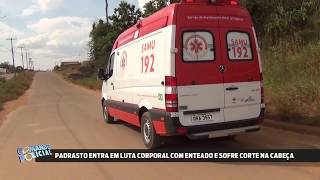 Padastro Entra Em Luta Corporal Com Enteado E Sofre Corte Na Cabeça