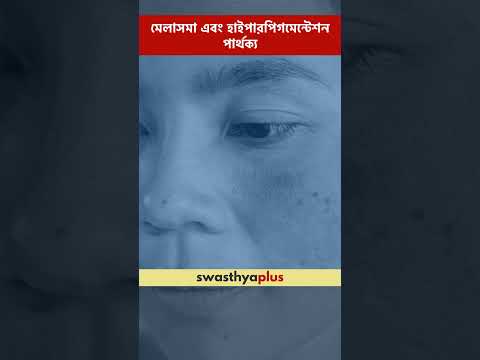 মেলাসমা এবং হাইপারপিগমেন্টেশন:পার্থক্য|Melasma & Hyperpigmentation:Difference|Dr Rohan Bhattacharjee
