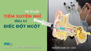 KỸ THUẬT TIÊM XUYÊN NHĨ ĐIỀU TRỊ ĐIẾC ĐỘT NGỘT