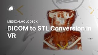 DICOM to STL Conversion in VR