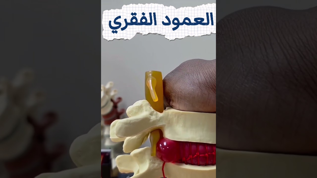 نصائح دكتور سامح الطبية عن العظام والركبة وإصابات الملاعب
