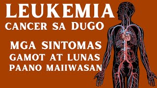 Leukemia  Mga Sintomas, Sanhi, Lunas at GAMOT | CANCER sa DUGO