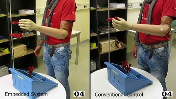 Simultaneous Control of Multiple Functions of Bionic Hand Prostheses Performance and Robustness in E