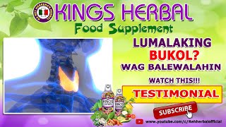 Lumalaking Bukol? Wag Balewalahin Hyperthyroidism & Cyst Kings Herbal Testimonial