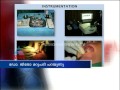 Doctor Live: Artificial dental implants